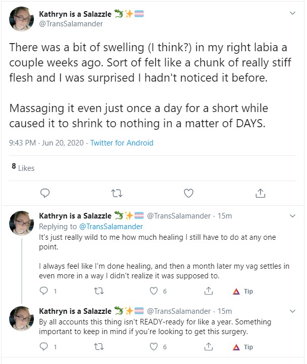 2006kevviewoundshit.jpg
