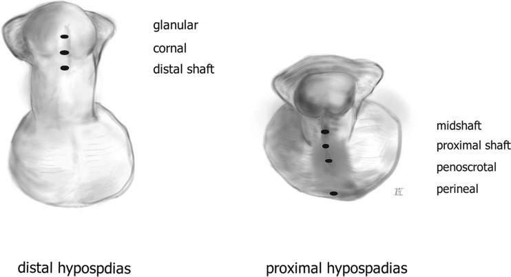 431_2017_2864_Fig1_HTML.jpg