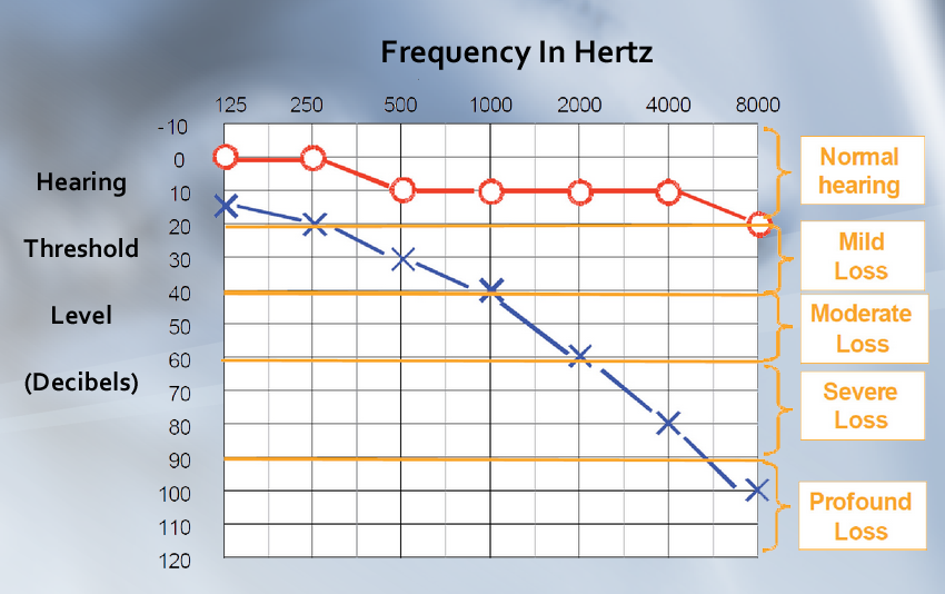 audiogram2.png