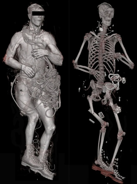 autopsy-22.webp
