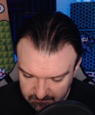 bald.png