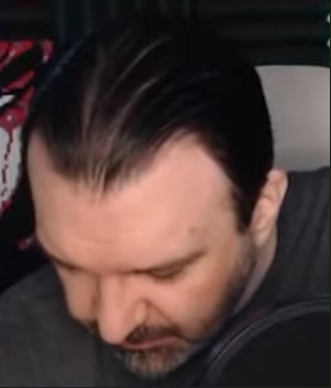 bald.png