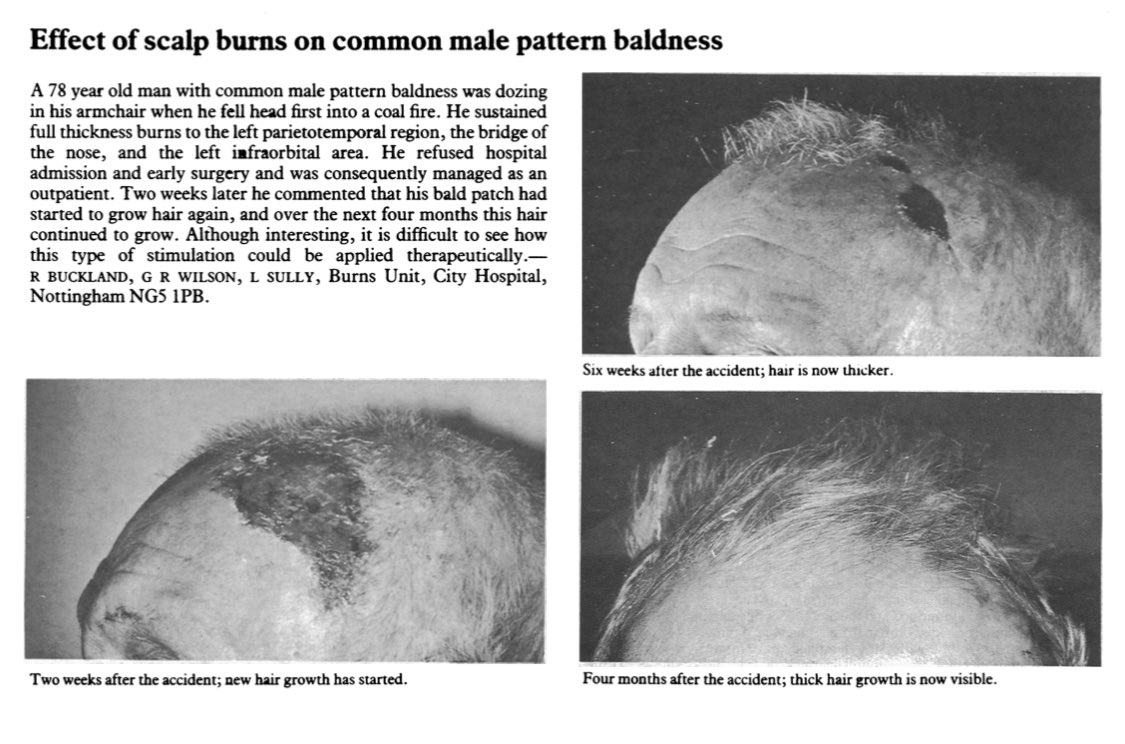 budget_microneedling.jpeg
