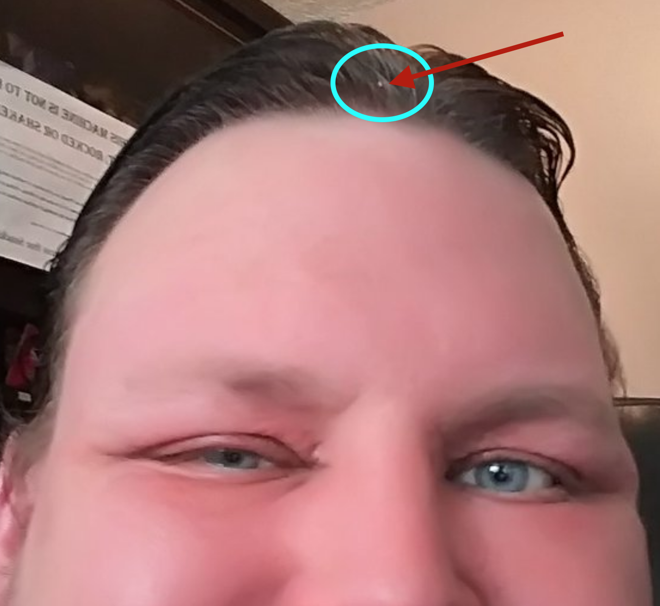 bug.png