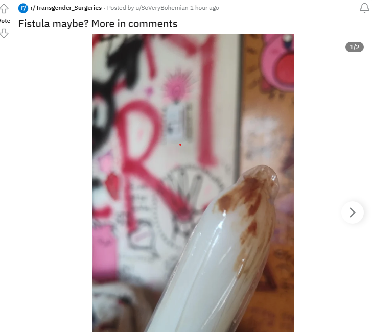 Capture.png