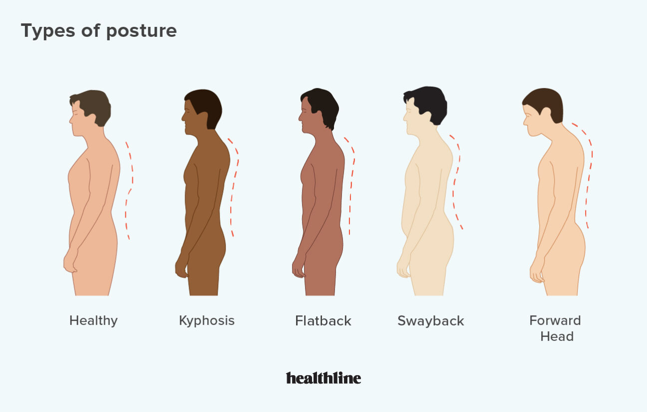 DSPPosture2.jpg