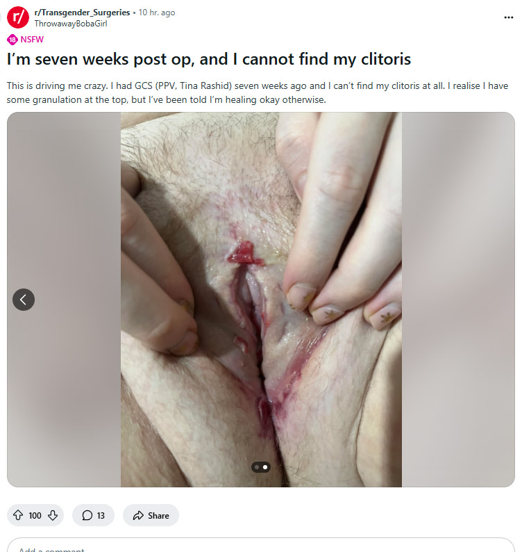 Extended_asscrack_Rashid2.jpg