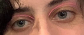 eyelids.webp