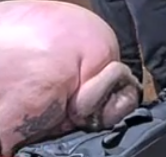 fatty.png