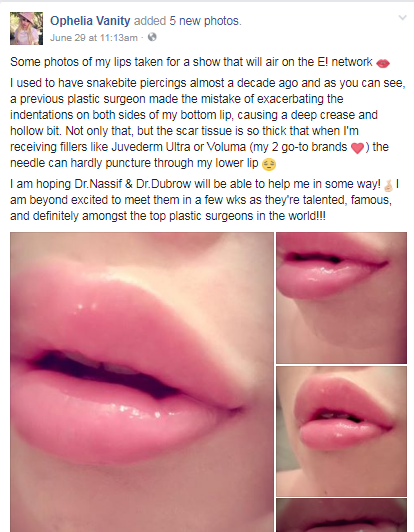 fb4.png