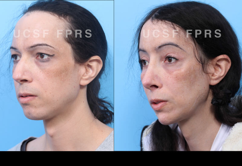 ffs-case7ef.jpg