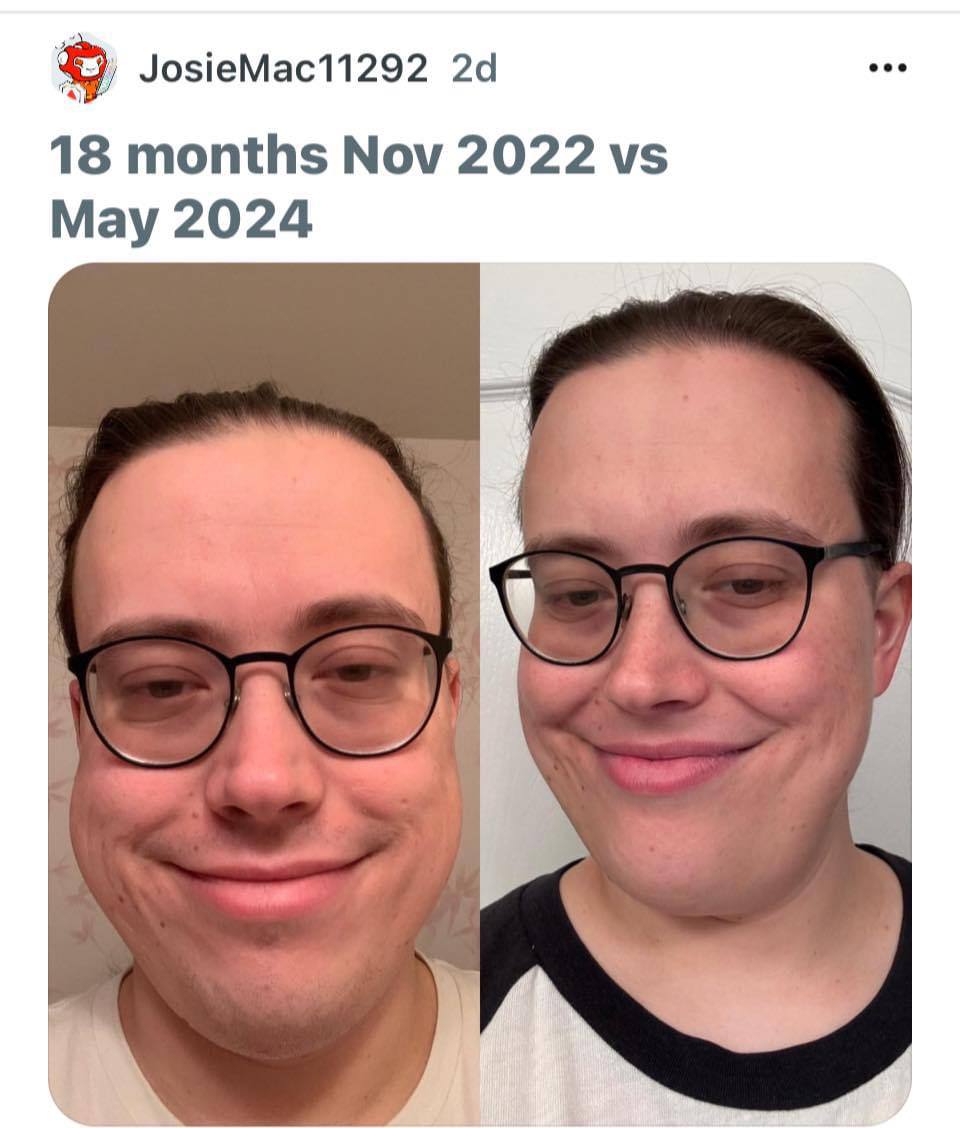 GOiXfnJW0AA8NZ-.jpg