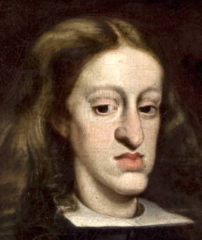 habsburg-jaw-of-charles-ii.jpeg