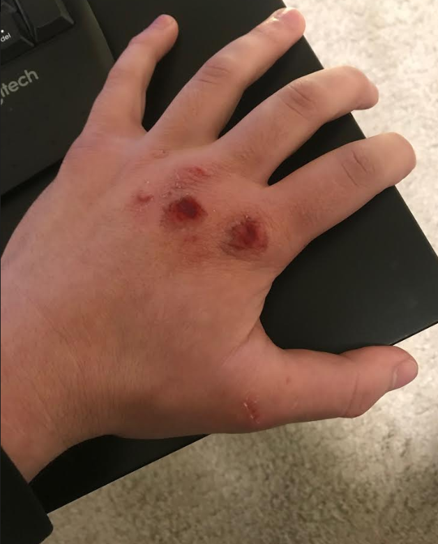 hand.PNG