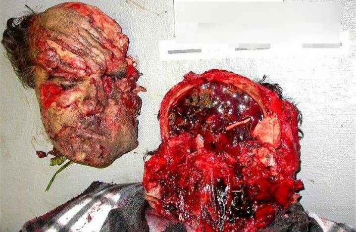 head-face-missing.jpg