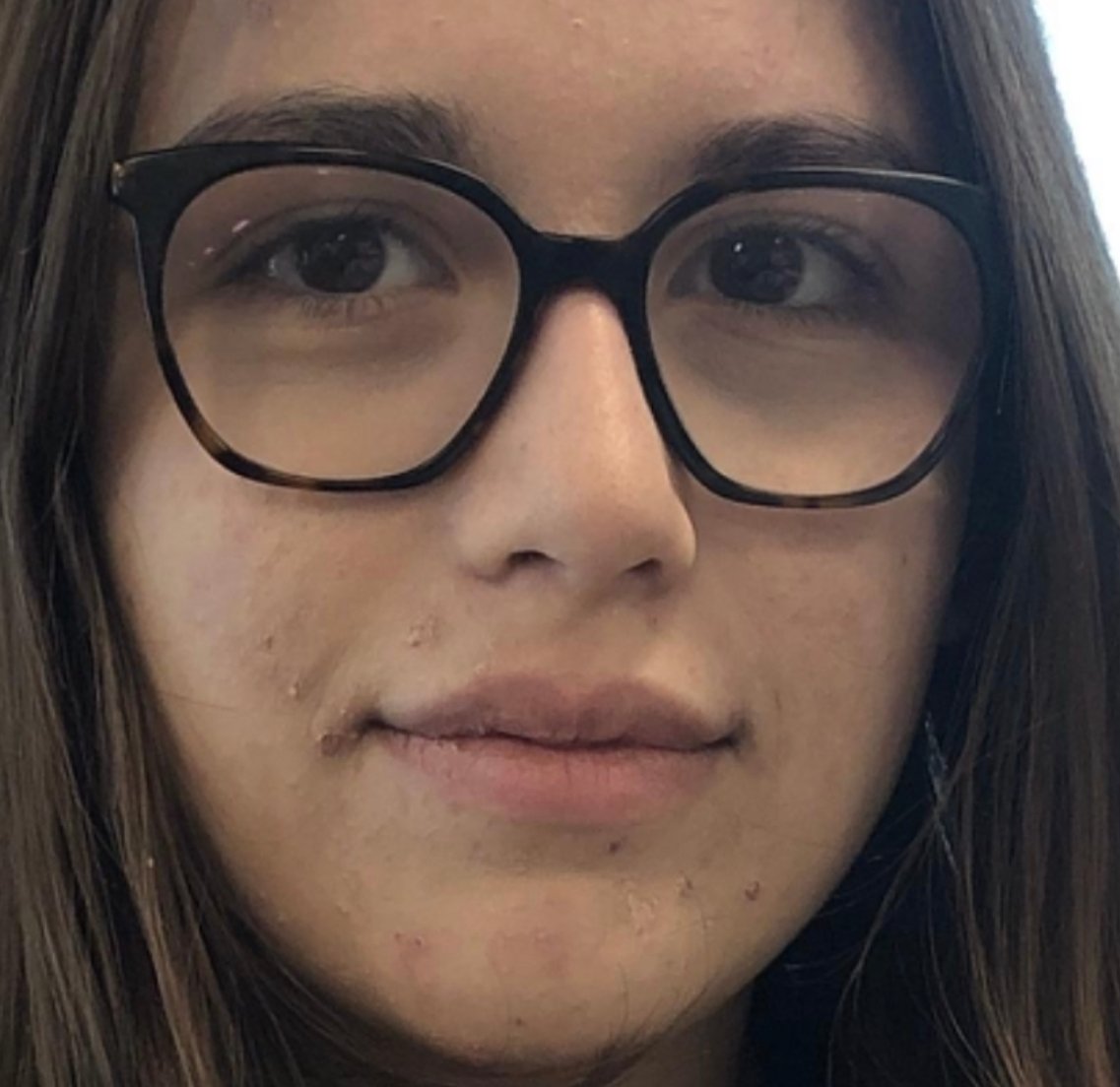 herpees.jpeg