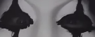 lazy eye lodini.png
