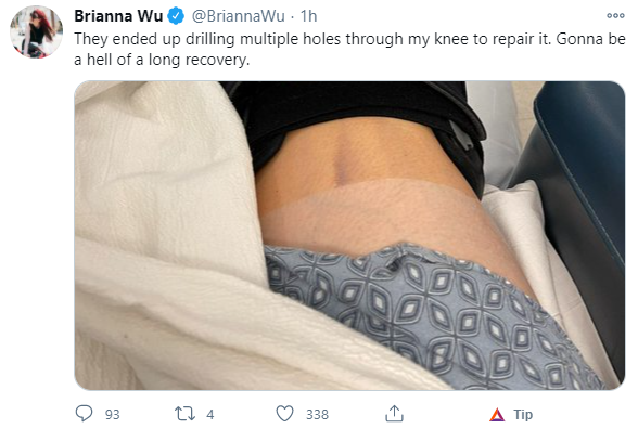 leg.png