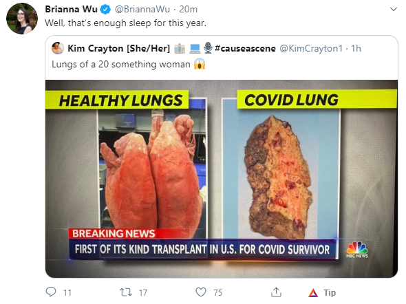 lung.png