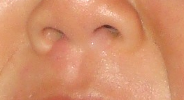 Maxillary Region.png