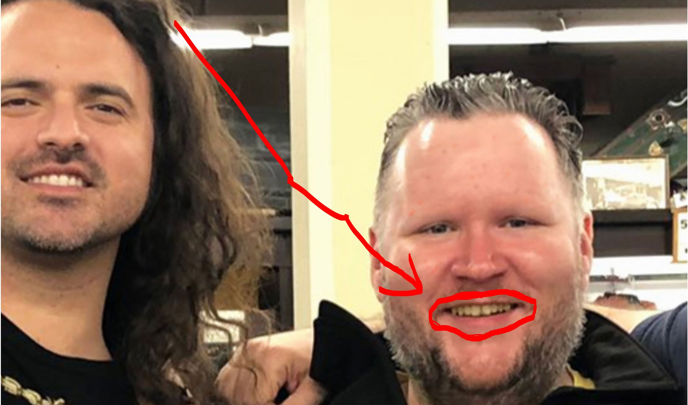 methteeth - Copy.JPG