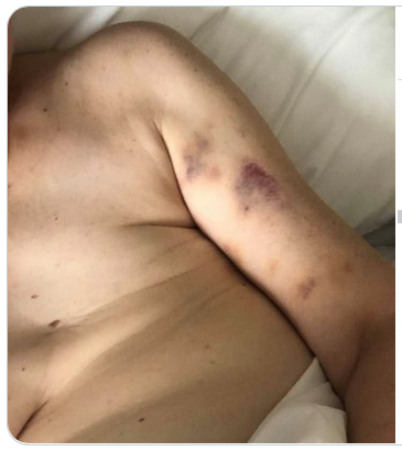 missingtit.png