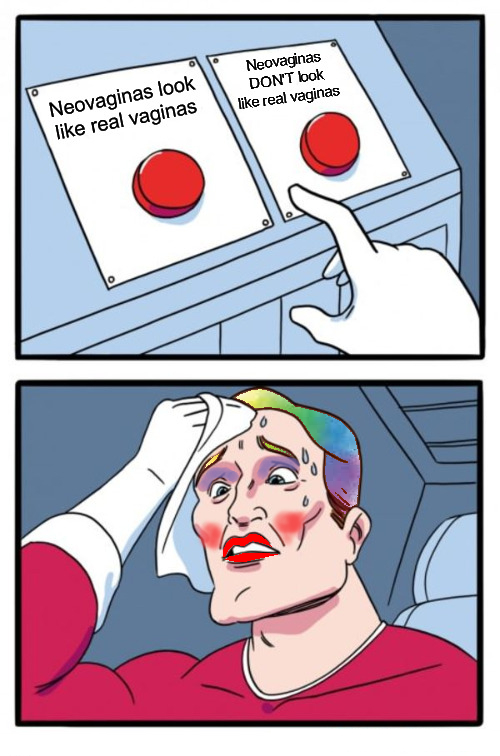 neovagbuttons.jpg