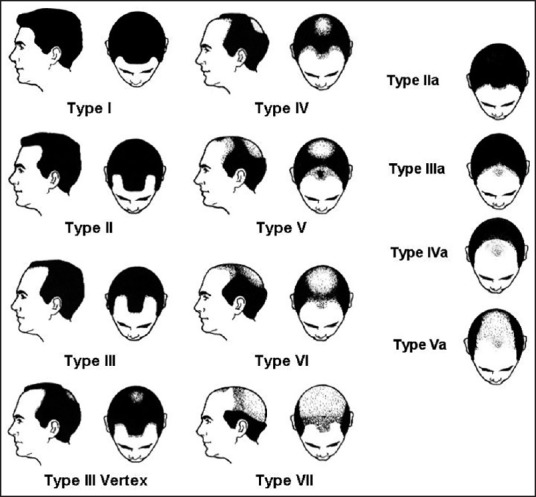 Norwood_Scale.jpeg