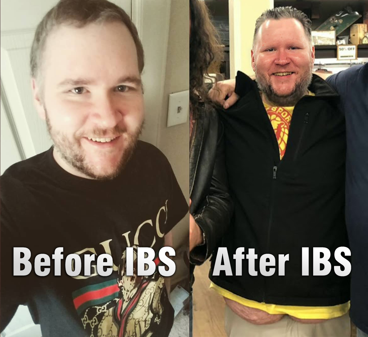Ralph_Before_After_IBS.png
