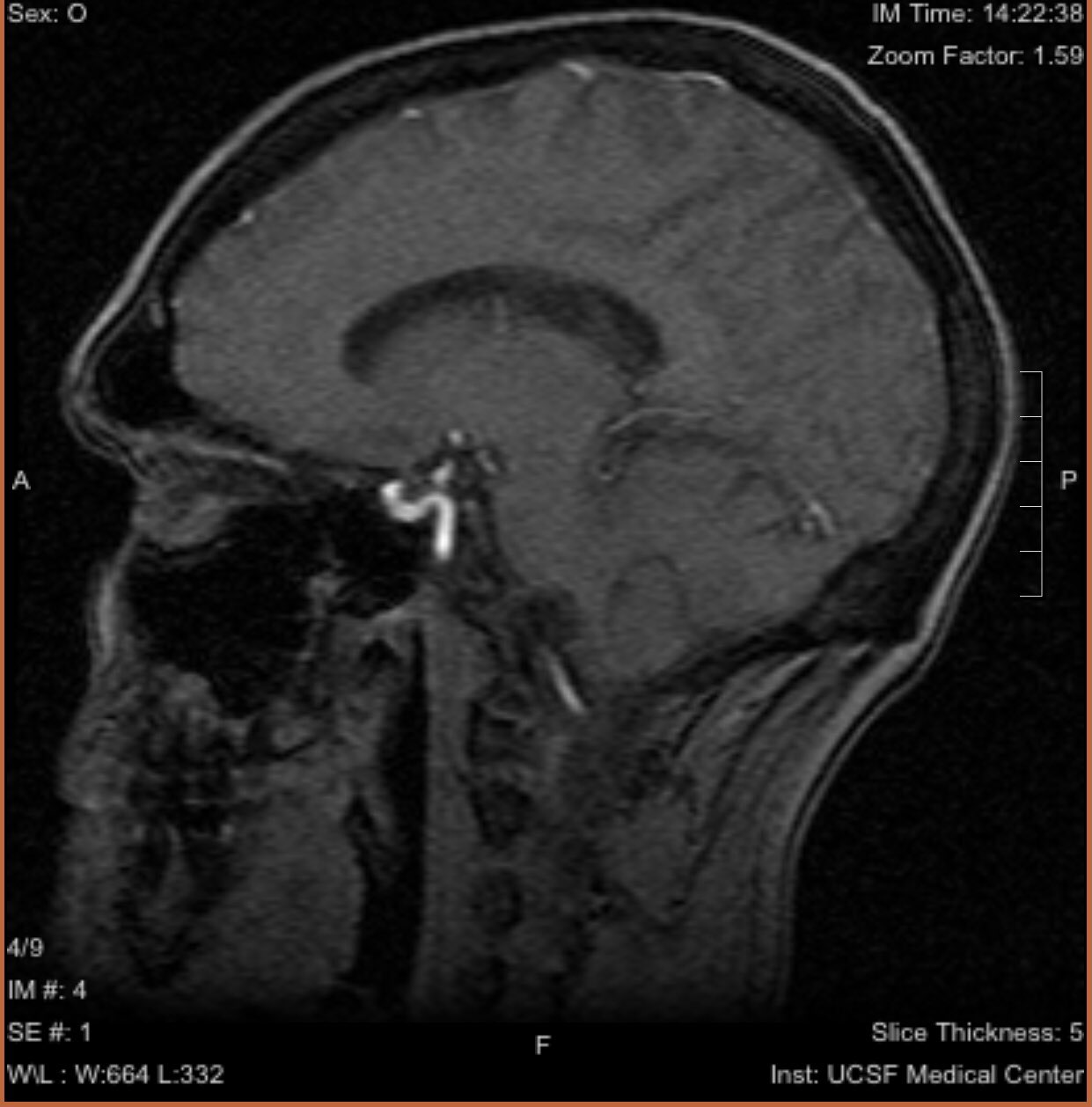 ripley_mri_1.jpeg