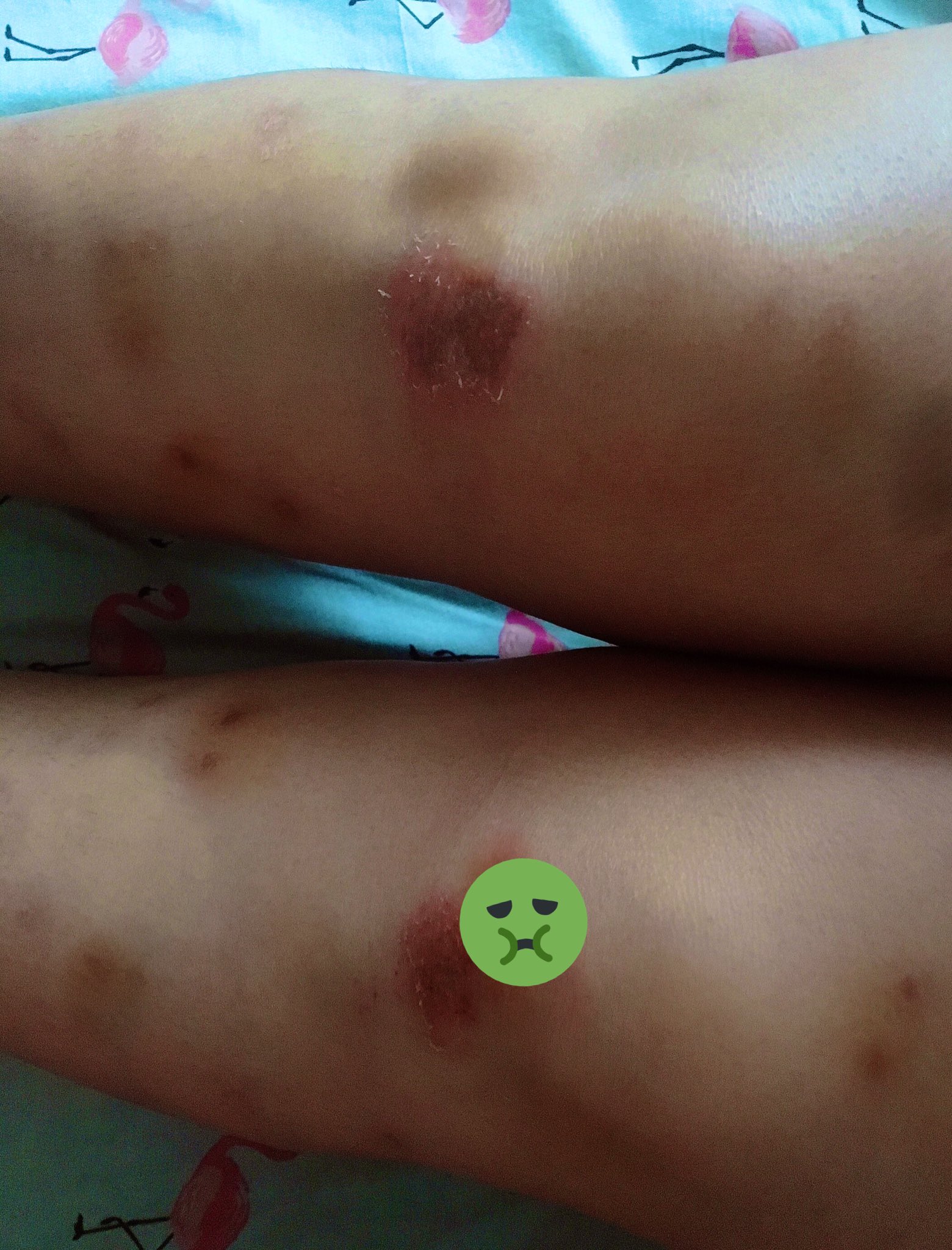 scars.jpg