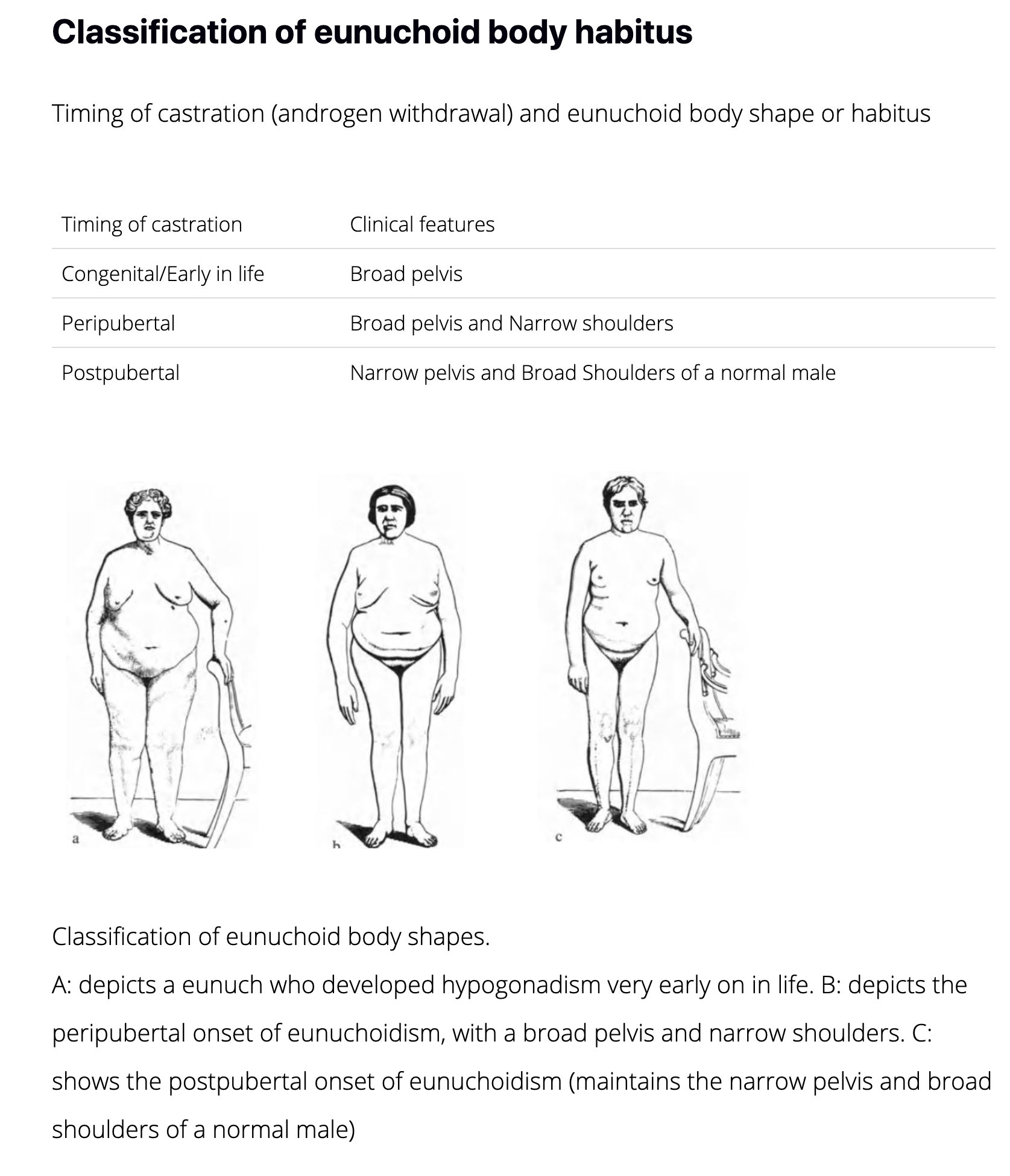 screencapture-myendoconsult-learn-eunuchoid-body-shape.png