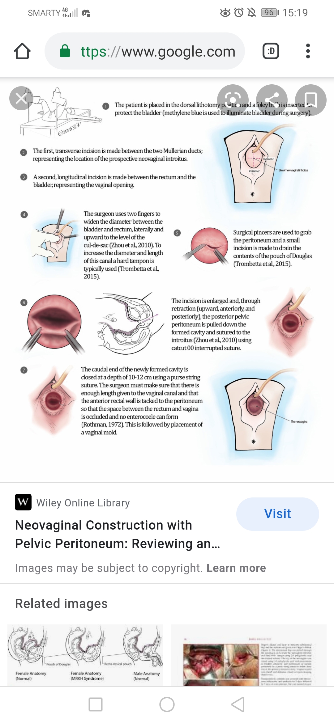 Screenshot_20210103_151950_com.android.chrome.jpg
