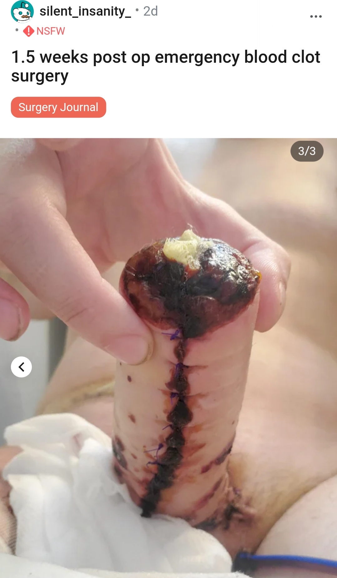 Screenshot_20211015-201839_Chrome-01.jpeg