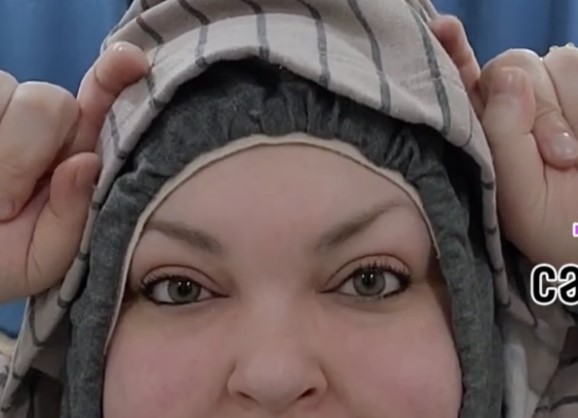 sick_eyes3.jpeg