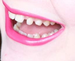 teef.jpg