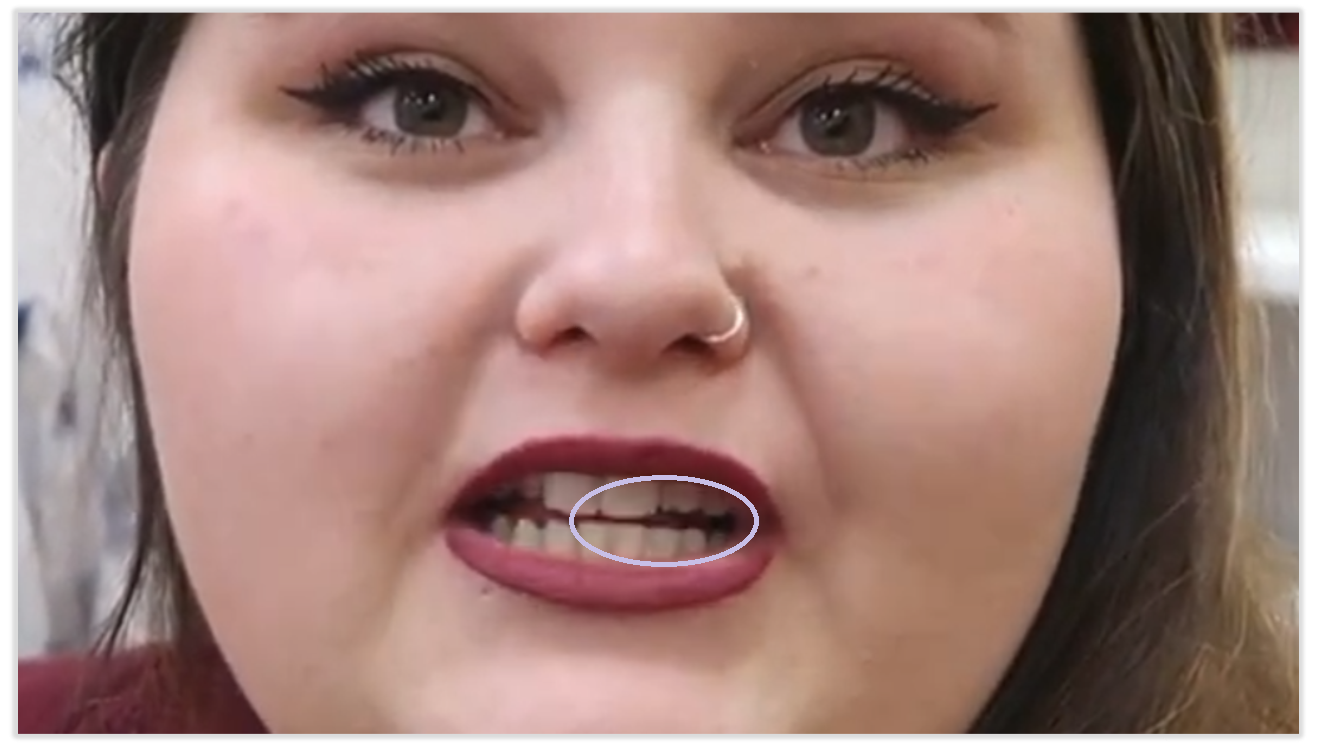 teeth.png