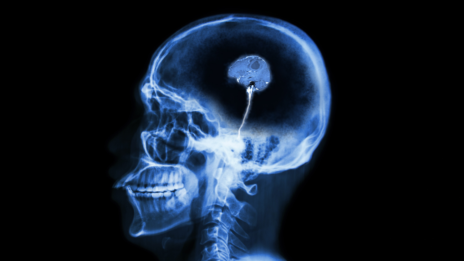 TinyBrain.jpg