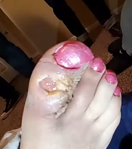 toe.png