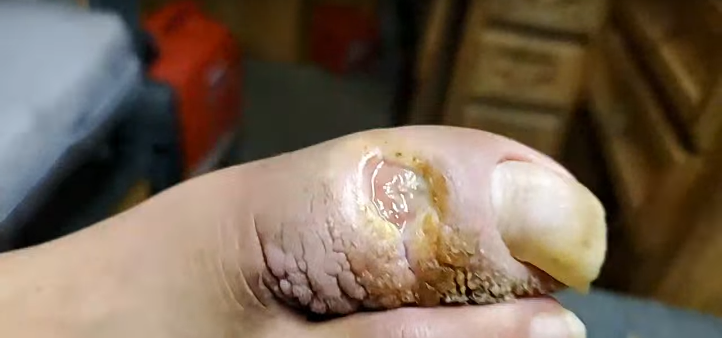 ToeAgain.png