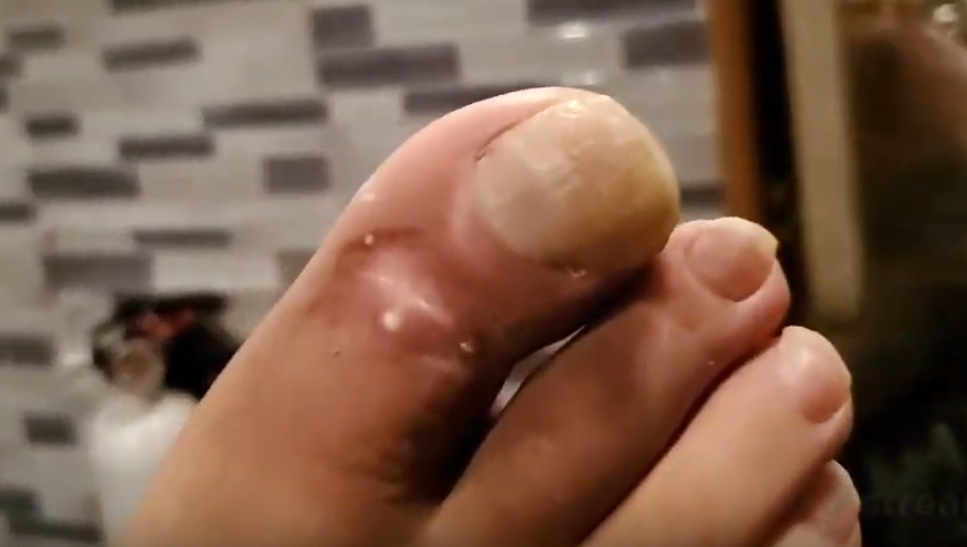 ToeUpdate.png
