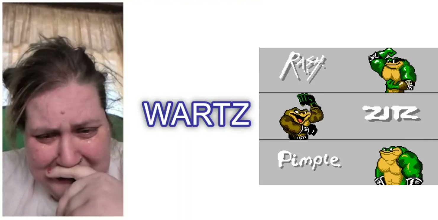 wartz.jpg