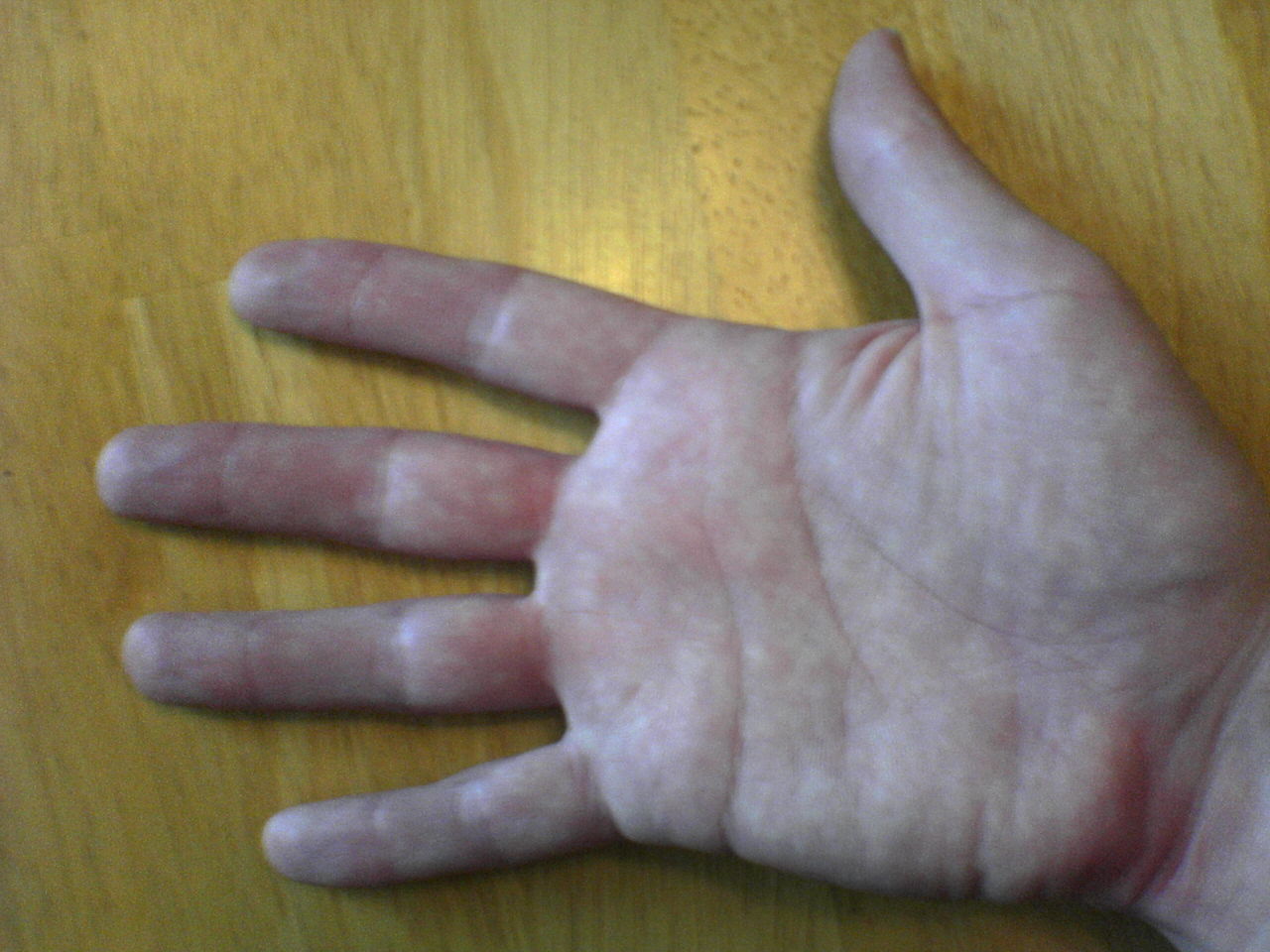 Right_hand.JPG