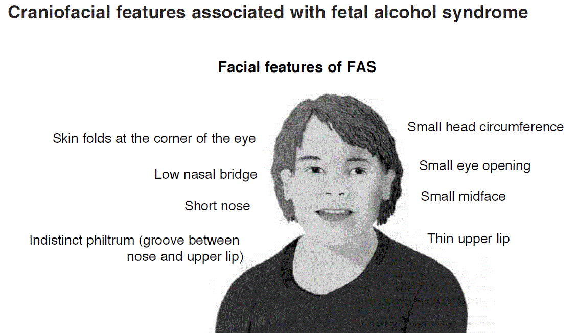 FASkid.gif