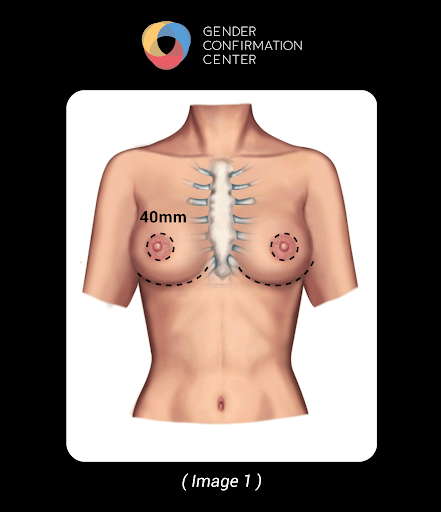 www.genderconfirmation.com
